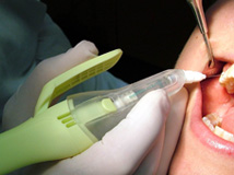 Mouth 3